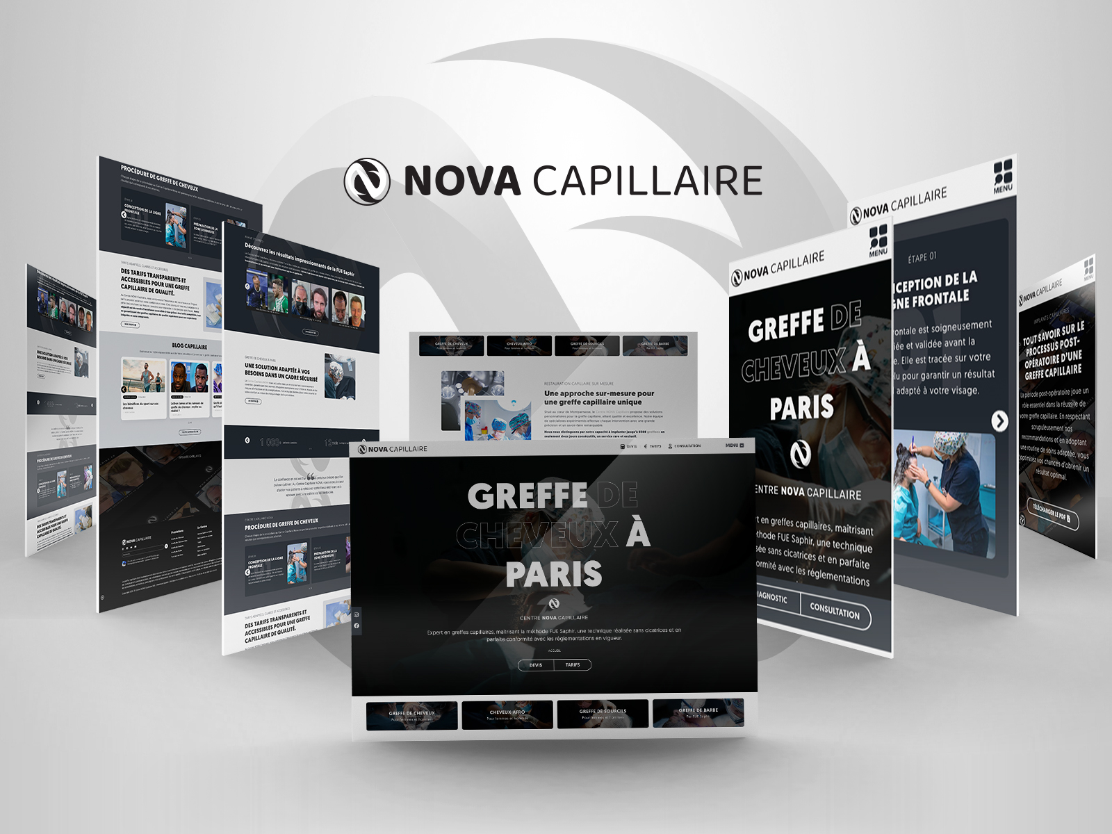 NOVA Capillaire (Home Page)