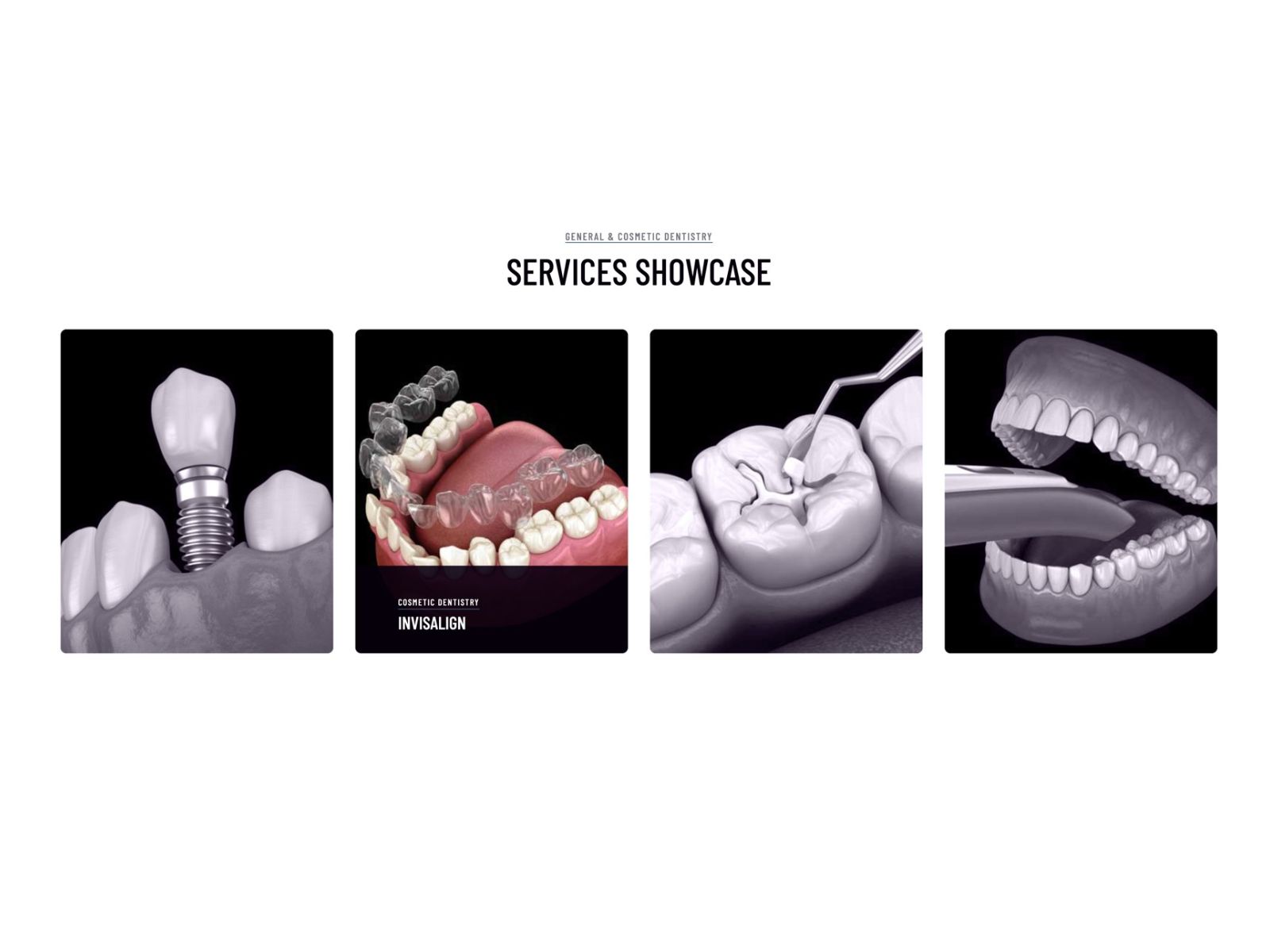 Service Showcase