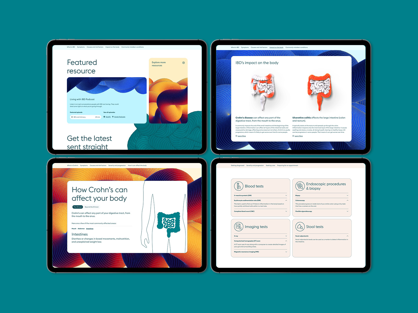UI Elements