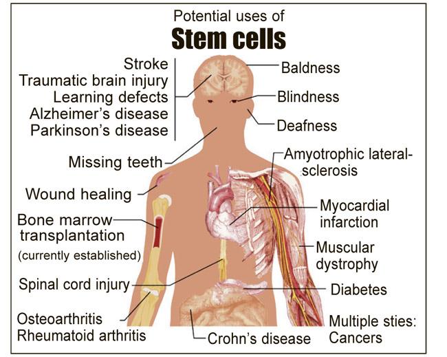 How are Stem Cells Used 