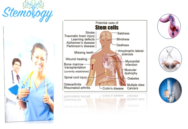 How are Stem Cells Used - Benefits of Stem Cells - Stemology.co.uk 