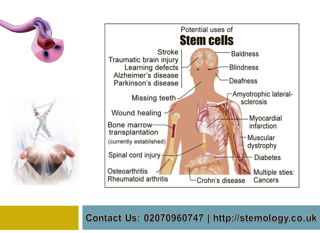 How Stem Cells Used - Stemology.co.uk