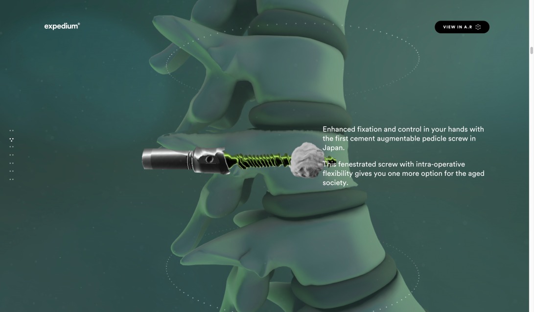 Expedium Verse® Fenestrated Screw System