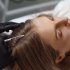 PRP Hair Treatment in Riyadh